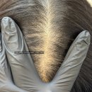 6 | 김포정수리문신 6개월후기 리터치변화