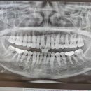 용인선플란트치과의원 이미지