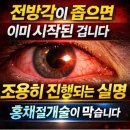 송탄성모안과의원 네이버블로그
