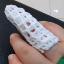 한사랑정형외과의원 | 어린이 차 문 손가락 끼임_손가락 피멍_대전한사랑정형외과후기_일요일진료_야간진료