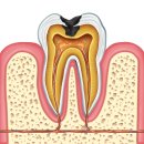 모아덴탈솔루션치과기공소 | 부산에 전체 임플란트 잘하는치과 찾기 힘드시죠? 여기 5곳 모아놨습니다