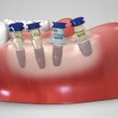 ㈜진덴탈 이미지