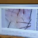 더샵헤어닥터 | [닥터스칼프 인천 송도점] 난생처음 받아본 두피관리 (내돈내산, 정기권 결제 안 함)