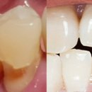 덴타피아치과의원 이미지