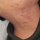 서라벌한의원 | 부산아토피한의원, 같은 한약을 먹어도 결과가 갈리는 1가지 이유