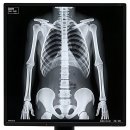 다이브의원 | 으슬으슬 허리가 삐걱! 이럴 땐 정형외과 텐션 올려야죠