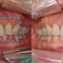 수원탑플란트치과의원 이미지