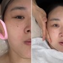 양지마을3로 4-15 | 초롱꽃 마을 H뷰티리움에서 힐링받고 온 피부관리 후기
