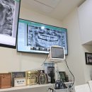 미주치과의원 | 강남레옹치과 사랑니 수면마취 발치 후기 (치과 공포증, 통증, 회복, 실밥 제거까지 총정리) 편원장님
