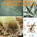 은피부관리