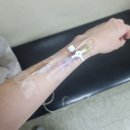 김외과의원 | 치핵수술 1일차