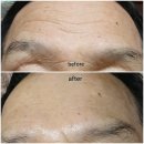 골드 휴 이미지