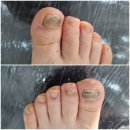 레푸스 앤 두두네일 이미지