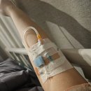 용이수정소 | 시험관 시술 과정 ㅣ 네 번째 방문 난자 채취 후기 및 관리ㅣ 수원 아이오라여성의원