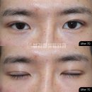 뷰라밸성형외과의원 이미지