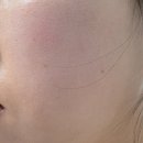 PDRN크림 추천 리쥬베닐 리페어 PDRN 1500 재생크림 약국 진정크림
