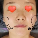 후끈한닭선생 | [경기 구리] 거꾸로 가는 시간 구리 갈매점 (후기, 영업시간, 구리 피부관리, 구리 다이어트)