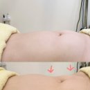 일로-9 | 홍대복부관리 일로왁싱 아로마 뱃살 슬리밍관리 솔직후기