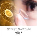 [렌즈 낀 채 샤워했는데 실명? ] 이미지