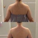 라인에스테틱 - 천안시 동남구 | 경산웨딩케어 브리앙뜨 에스테틱 드레스 라인 케어 후기