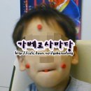 연지곤지