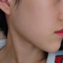 미화농장 | 서초 교대역 스킨부스터 리투오로 피부컨디션 개선!