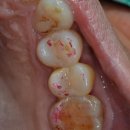 오케이치과기공소 이미지