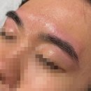메디칼빈센트약국 | 거울 볼 때마다 스트레스? 인계동 남자 왁싱으로 찾은 깔끔한 인상 변신 후기