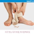 다리부종 원인 다리가붓는이유 알아볼까요 이미지