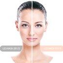 모바닉 | 지친피부 이제부턴 리쥼led마스크