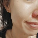 노란케어 119 | 촉촉쓰한 더멜라밤부토너 사용 후기 추천