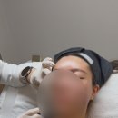 (주)쿠키라인 | 신논현피부과 쥬베룩 볼륨 3cc 내돈내산 솔직후기 (쥬베룩볼륨 통증, 효과, 가격)