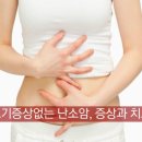 난소암의 원인과 증상개요 이미지