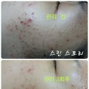 스킨스토리 이미지