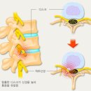 에이치엔피