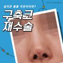 최우식노즈립성형외과의원 네이버블로그