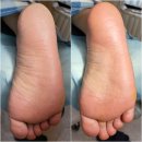 레푸스미아 | 강북 발관리 내성발톱 발각질 잘하는곳 레푸스 미아점에서 관리받고 온 후기