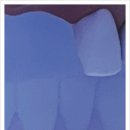 수성뉴플란트치과의원 이미지