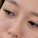 래쉬킴 이미지