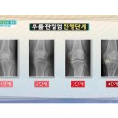 본튼튼마취통증의학과의원 네이버블로그