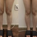 더비채움에스테틱 네이버블로그
