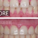 인비스치과의원 이미지