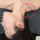 팔도실비집 부천원미점 | 부천에스테틱 파인드유 실력부터 남다른 승모근관리