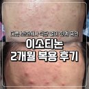 별2 | 이소티논 2개월 복용 후기 주차별 여드름 증상 변화 공유