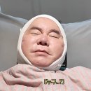 거상트레이드 | 67세 안면거상 후 팽팽한 얼굴 자랑한 심형래 전후 근황