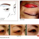 가본의학주 이미지