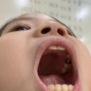 미소아치과치과의원 네이버블로그
