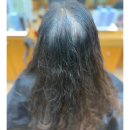 여자탈모정수리갈라짐과가르마교정고민으로방문한고객님 네번째시술방문기록 감사해유르네시떼미용실/ 센텀해운대우동광안리수영망미초량장전금정주례개금명 이미지