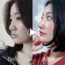 앤플러스의원 티스토리