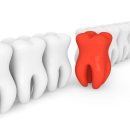 서울앤치과 이미지